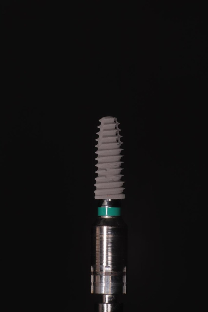 Implantes y Rehabilitación Oral